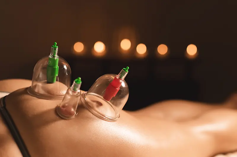 Cupping massage massagesalon Mari-Sage Nieuwegein